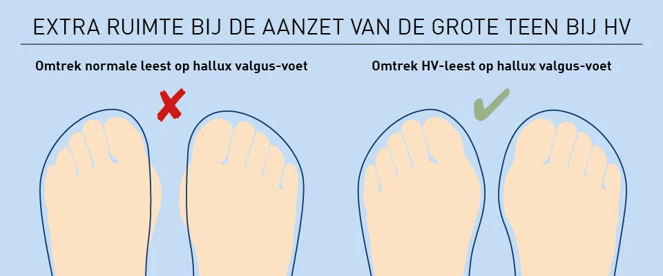 Hallux valgus schoenen